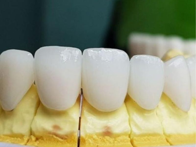 Răng sứ Zirconia
