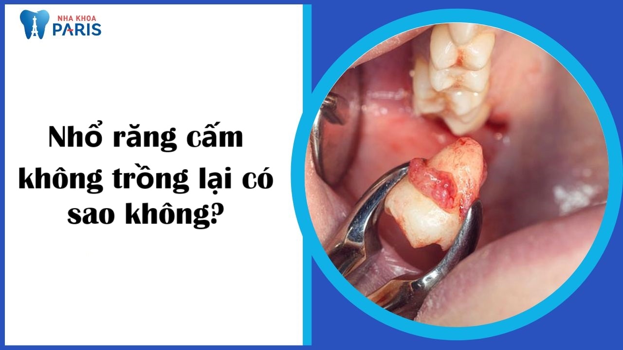 Nhổ răng cấm không trồng lại có sao không? cần lưu ý điều gì