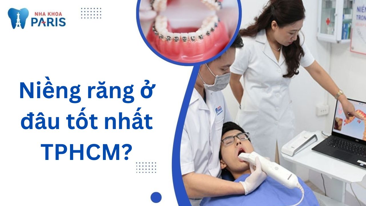 Niềng răng ở đâu tốt nhất TPHCM? Top 8 địa chỉ uy tín