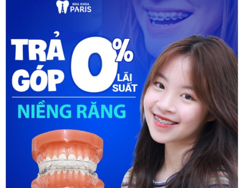 Niềng răng trả góp cho sinh viên với lãi suất 0% 