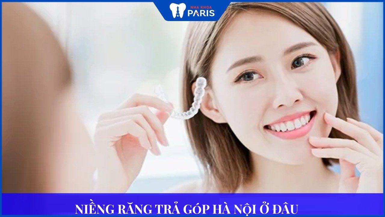 Niềng răng trả góp Hà Nội Gợi ý địa chỉ lãi suất 0%?
