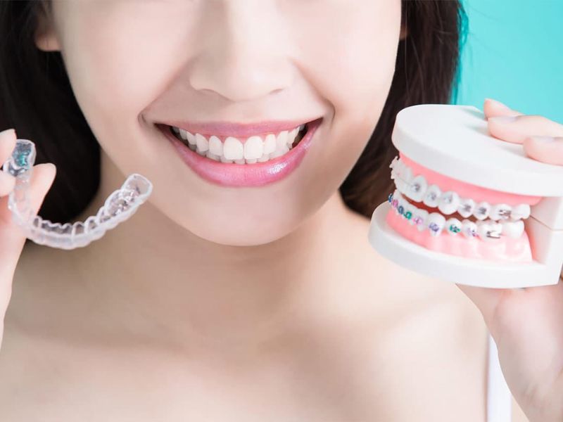 Niềng răng trả góp HCM giúp khách hàng chủ động tài chính, duy trì điều trị liên tục và đảm bảo chất lượng dịch vụ cao