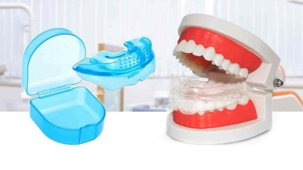 Niềng răng trẻ em silicon: Ưu – nhược điểm của phương pháp