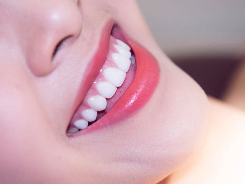 Răng sứ Emax phù hợp cho các trường hợp phục hình yêu cầu cao về thẩm mỹ và cảm giác tự nhiên