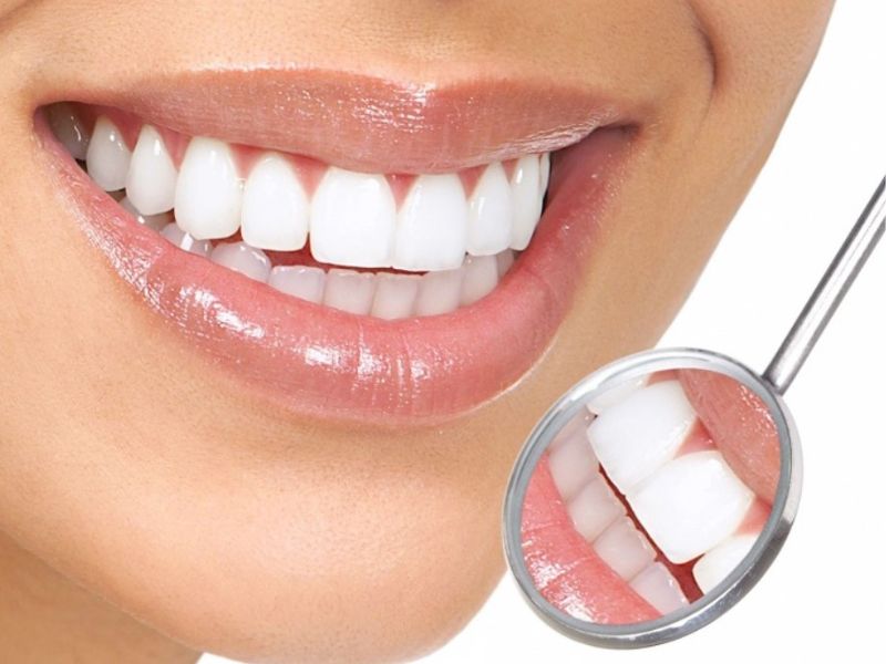 Giá răng sứ Emax dao động từ 5.000.000 – 8.000.000 VNĐ/răng