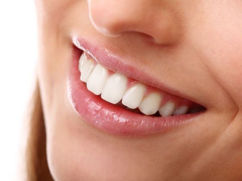 Răng sứ Lava Plus với nhiều ưu điểm nổi bật, có giá cao hơn các dòng răng sứ khác.