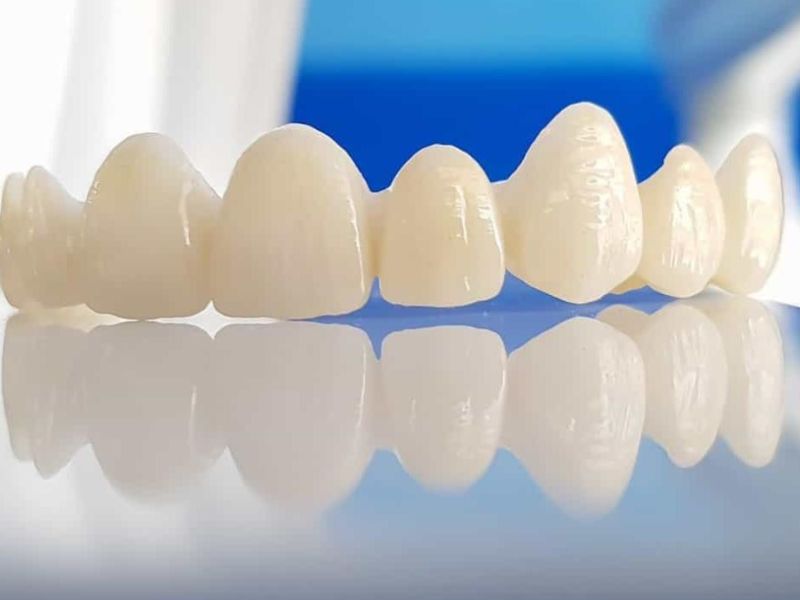 Răng sứ Lava Plus