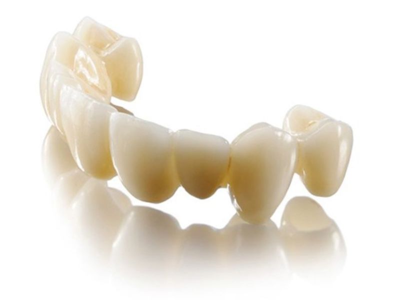 Răng sứ Lava Plus có mức giá dao động từ 8.000.000đ - 10.000.000đ/răng