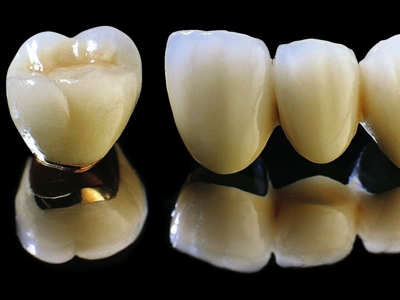 Răng sứ Titan tốt với độ bền chắc cao, khả năng chịu lực đến 600 MPa, ăn nhai như răng thật