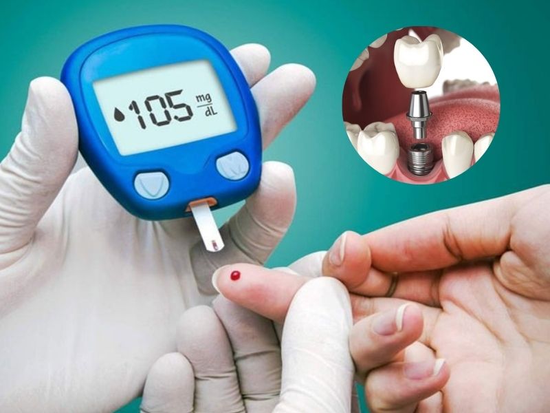 Người tiểu đường vẫn có thể trồng răng Implant nếu kiểm soát đường huyết tốt