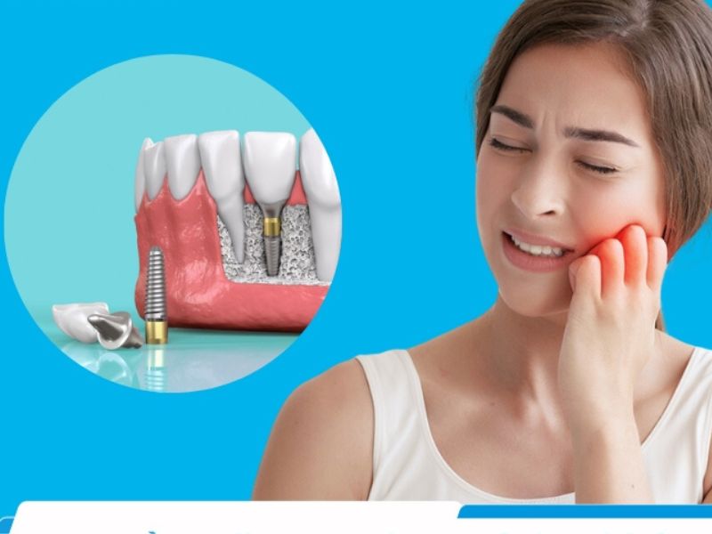 Trồng răng không gây đau
