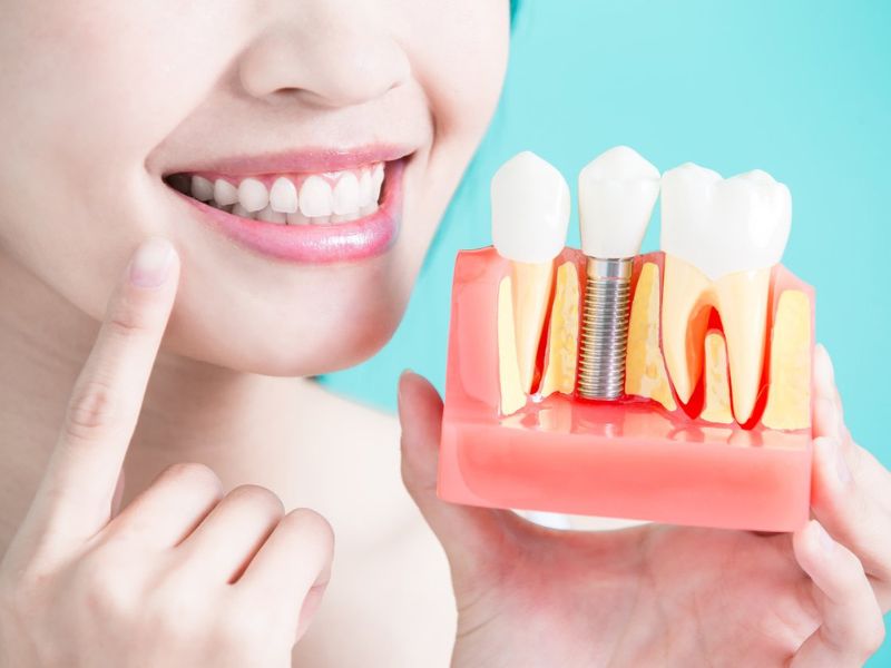 Nỗi lo trồng răng đau xuất phát từ nhiều nguyên nhân