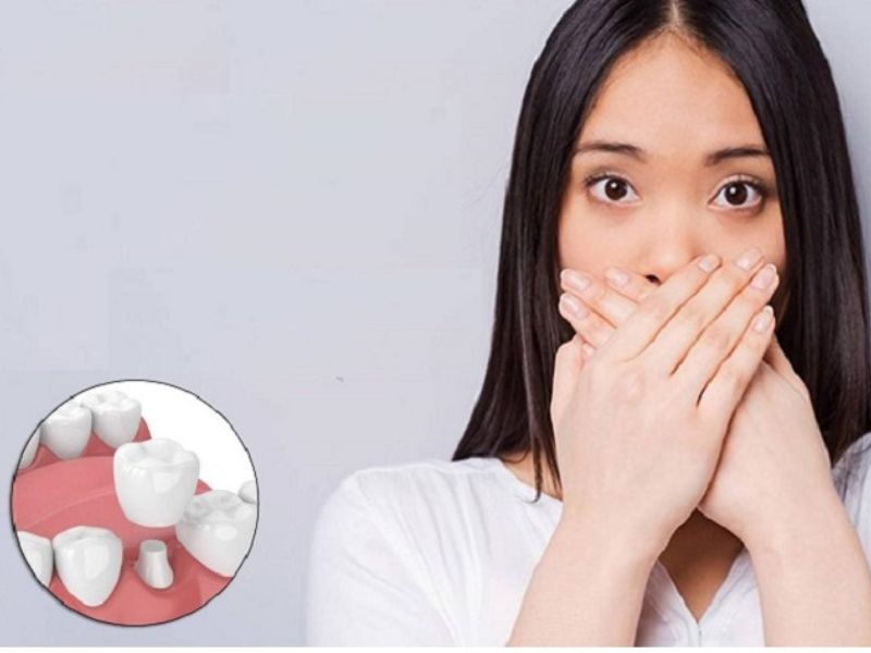 Trồng răng giả bị hôi miệng là không bình thường