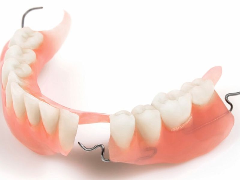 Răng giả tháo lắp phù hợp với người cao tuổi, mất nhiều răng, không muốn phẫu thuật.