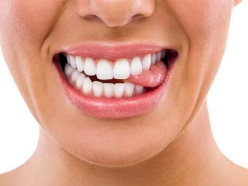 Răng không đều không thể tự chỉnh tại nhà