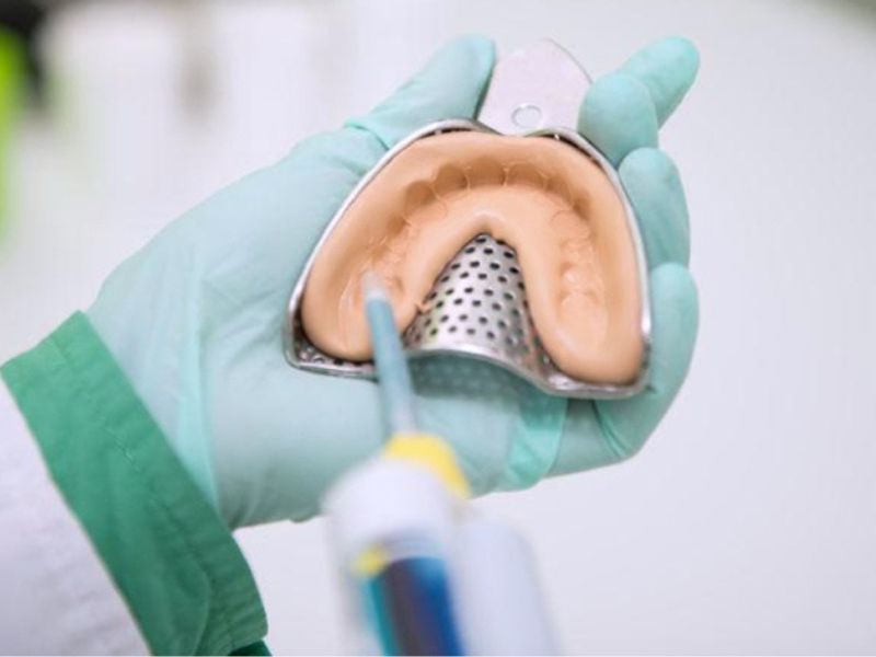 Lấy dấu răng sứ Titan