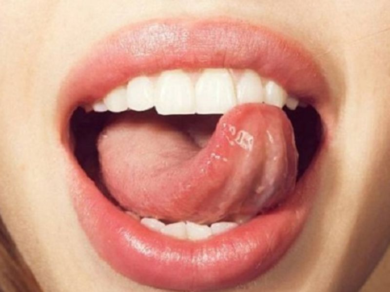 Dùng lưỡi đẩy răng - cách chỉnh răng mọc lêch không cần niềng