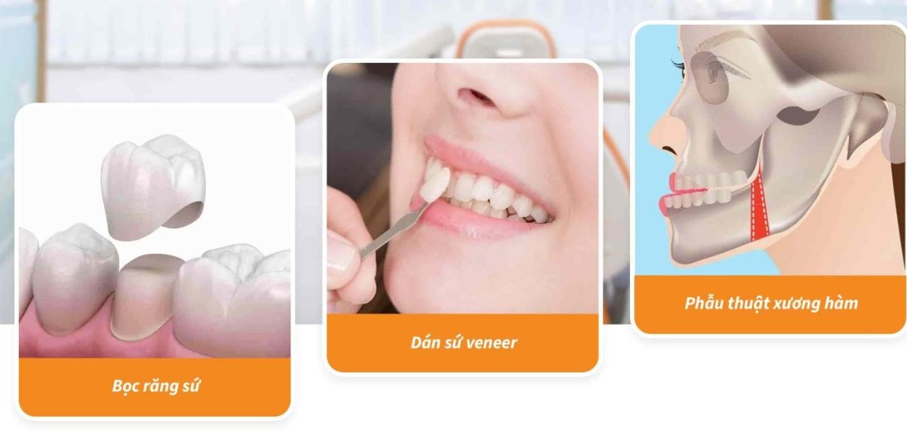 Chỉnh răng mọc lệch không cần niềng? cần lưu ý điều gì