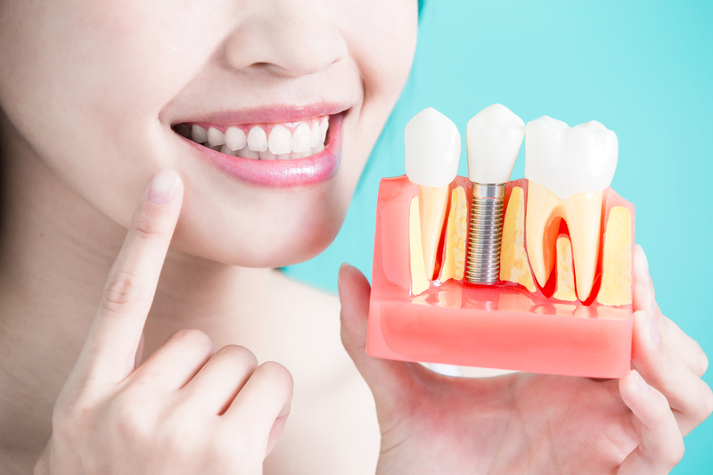 Trồng răng mang lại nhiều lợi ích về thẩm mỹ và sức khỏe răng miệng