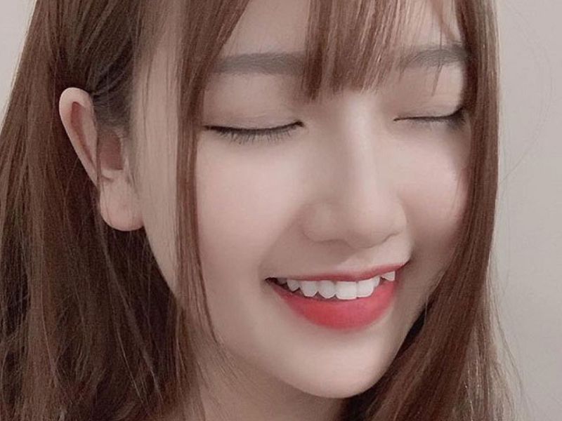 Hoàn toàn có thể trồng răng khểnh bằng nhiều phương pháp khác nhau