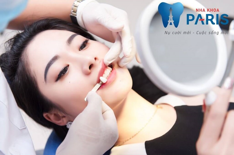 Trồng răng khểnh đẹp tự nhiên tại nha khoa Paris 