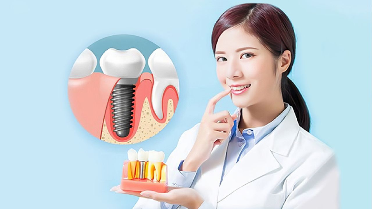 Bao nhiêu tuổi có thể trồng răng? một số trường hợp đặc biệt cần biết