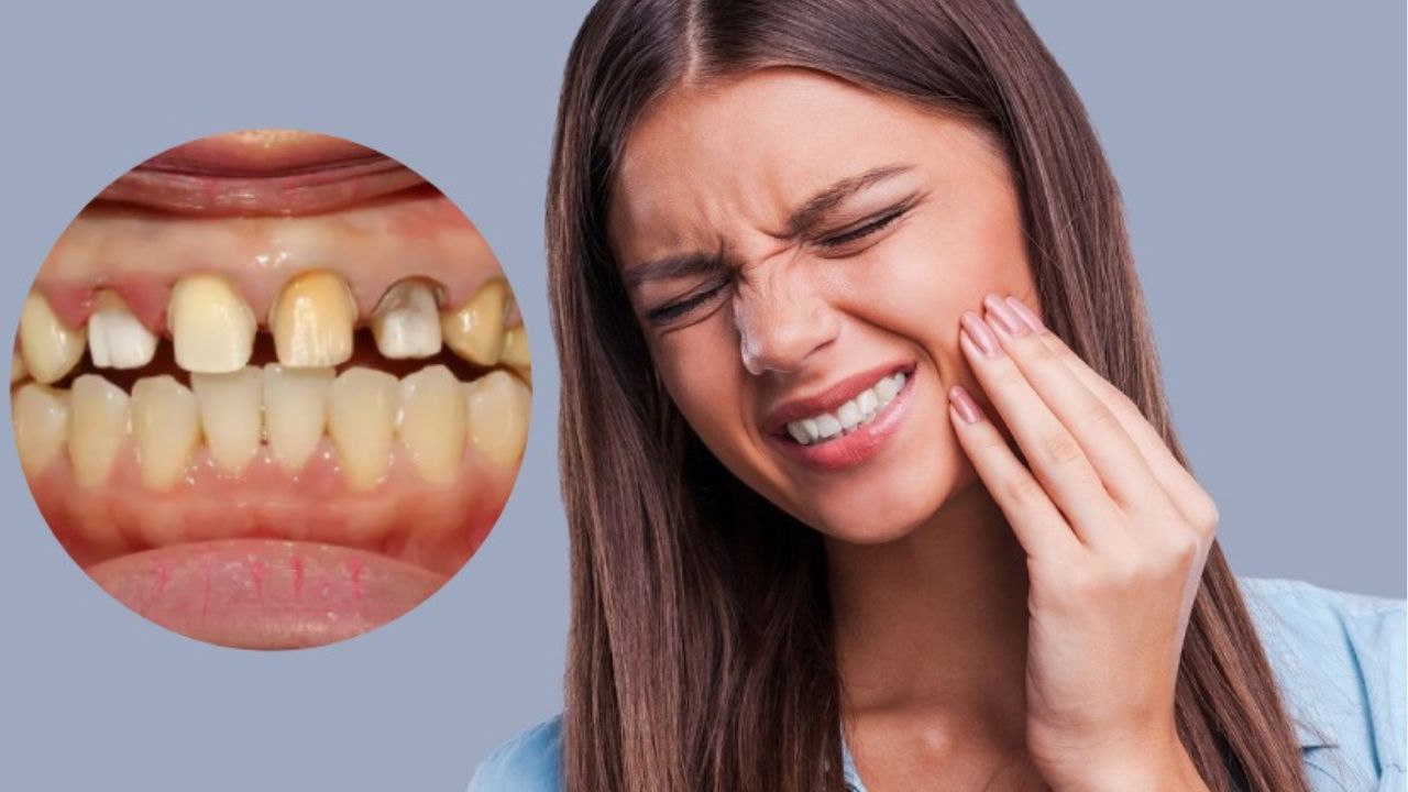 Hậu quả trồng răng sứ ? những lưu ý cần biết trước khi trồng răng