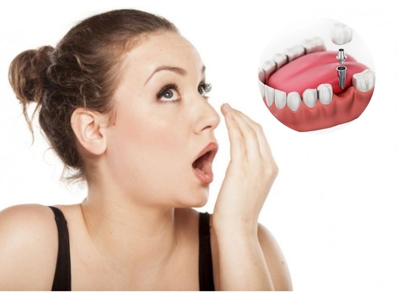 Trồng răng giả có bị hôi miệng nếu sử dụng chất liệu kém (đặc biệt là kim loại), lắp không sát khít nếu là hàm giả tháo lắp hoặc vệ sinh không kỹ