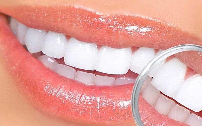 Trồng răng sứ không mài  giúp bảo tồn răng, không đau nhức