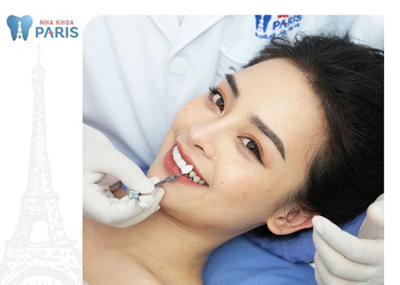 Khách hàng thực hiện trồng răng sứ an toàn tại Paris