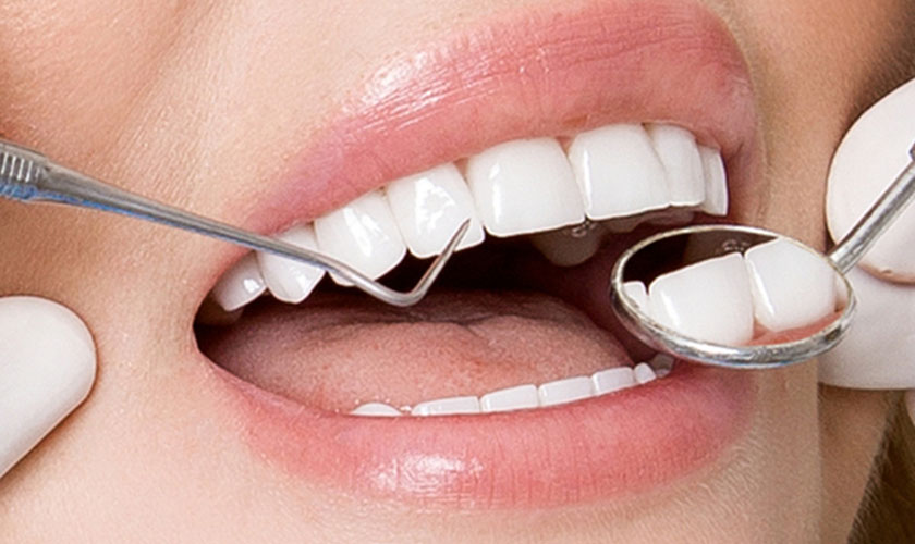 Trồng răng sứ không mài có cả ưu-nhược điểm
