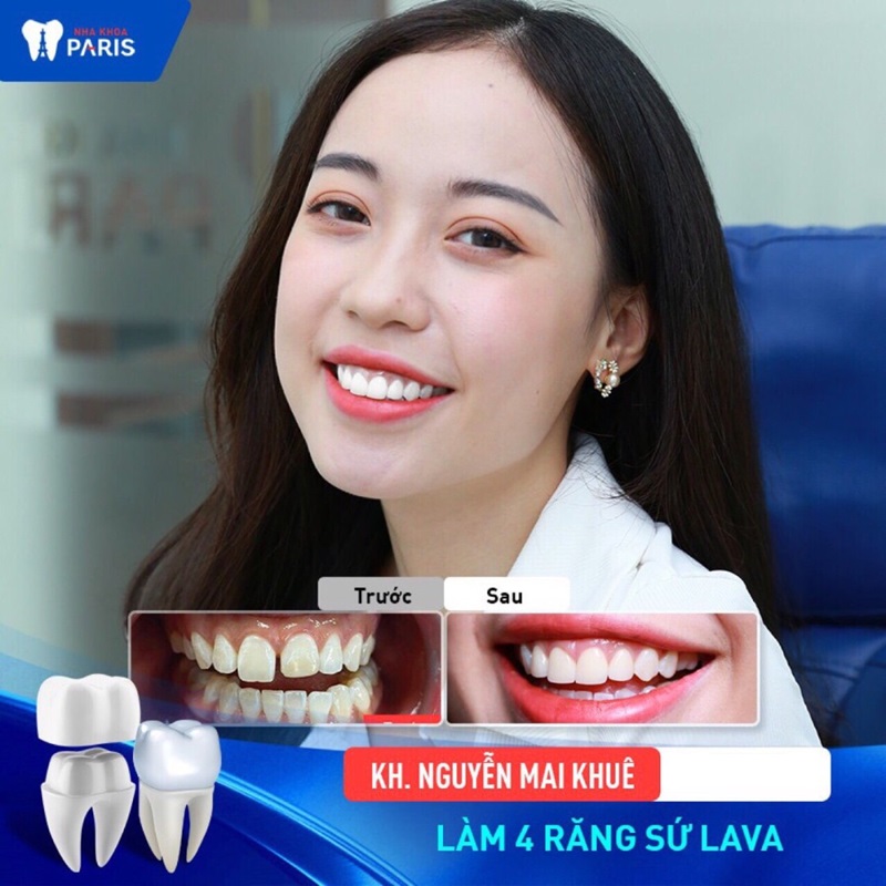 Khách hàng tin tưởng lựa chọn trồng răng sứ tại nha khoa Paris