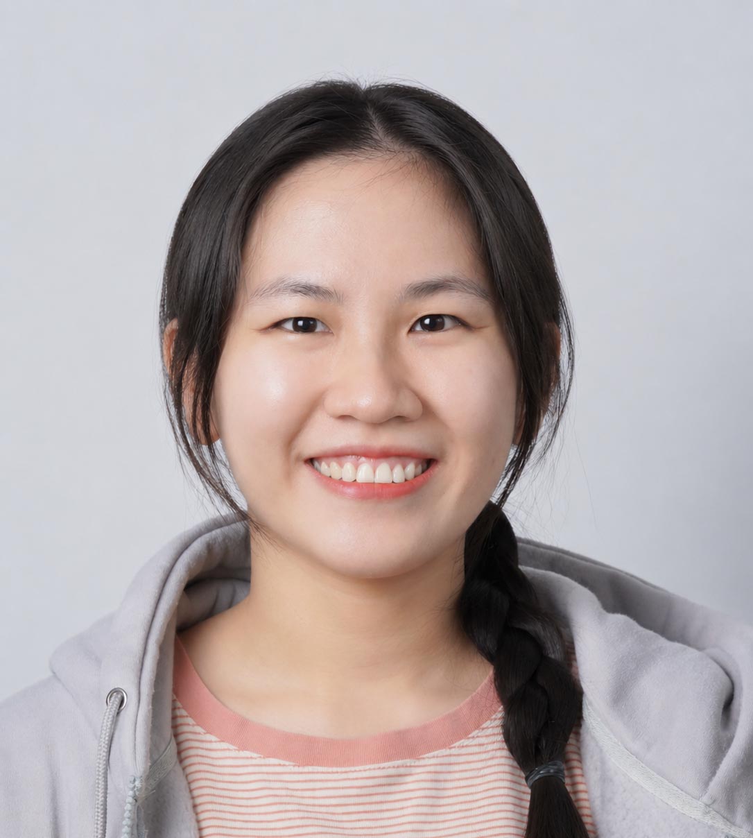 Uyên tự tin sau khi niềng răng, nụ cười tươi tắn, khuôn hàm cân đối