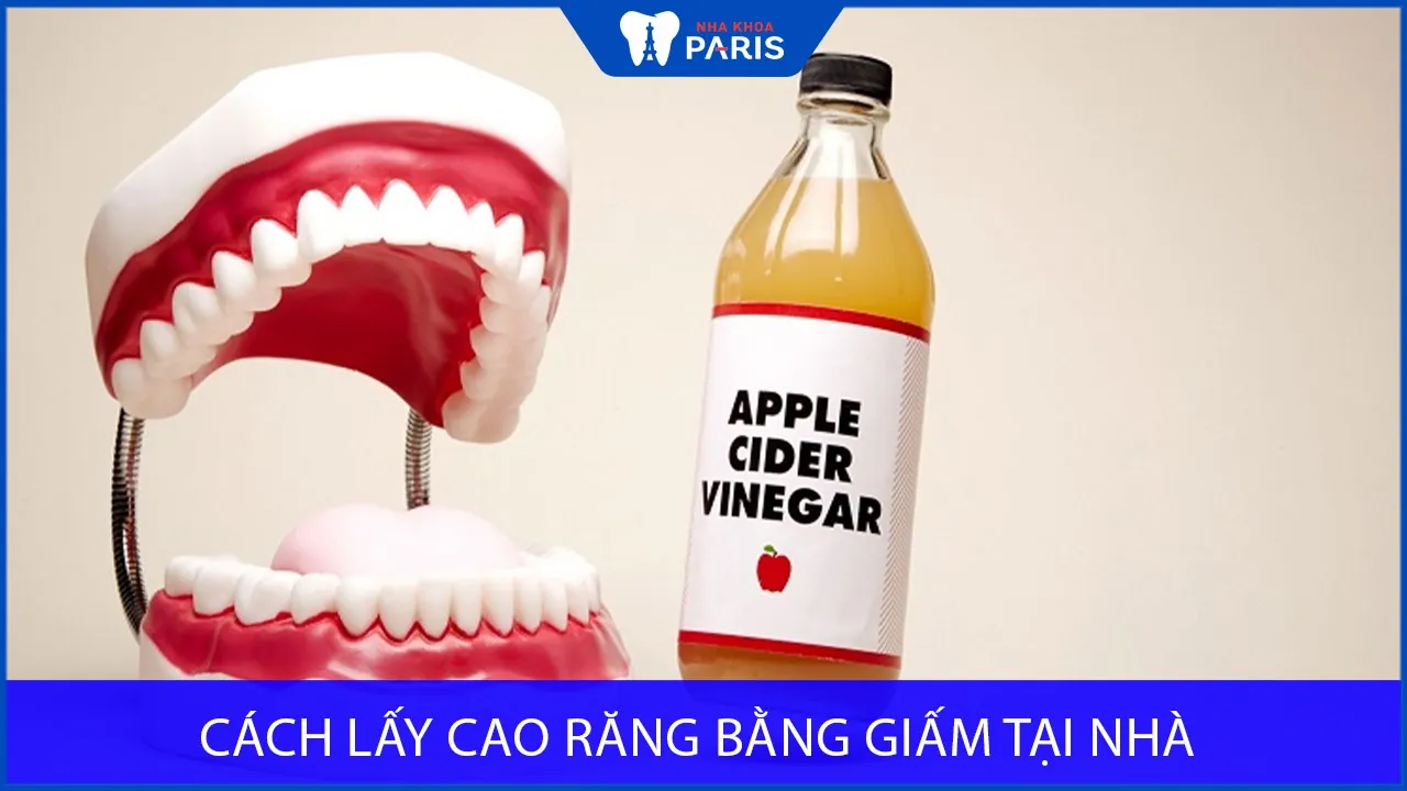 Cách lấy cao răng bằng giấm tại nhà – An toàn, hiệu quả