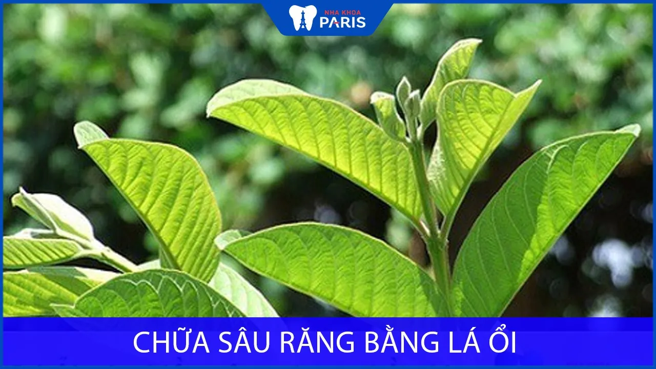Chữa sâu răng bằng lá ổi cực đơn giản tại nhà