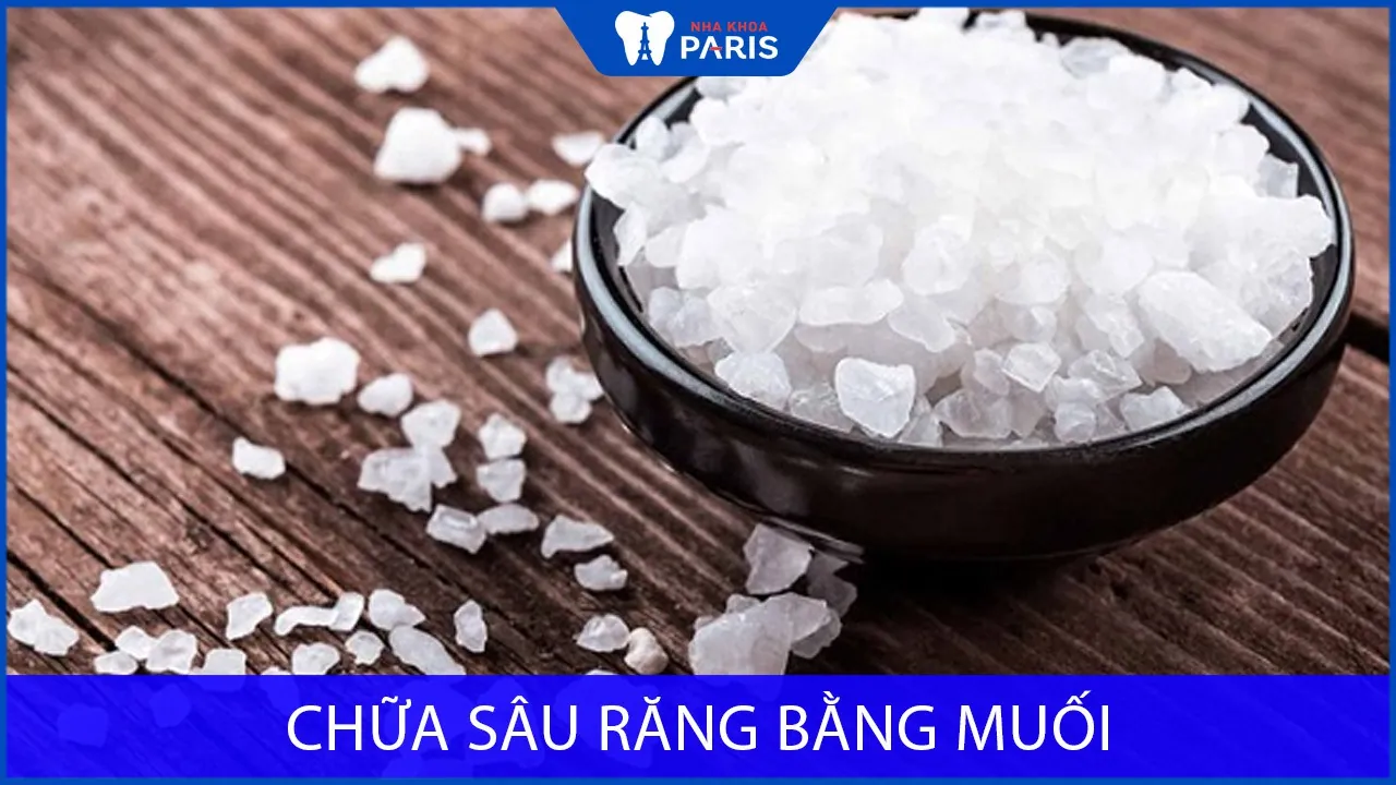 6 cách chữa sâu răng bằng muối hiệu quả tại nhà