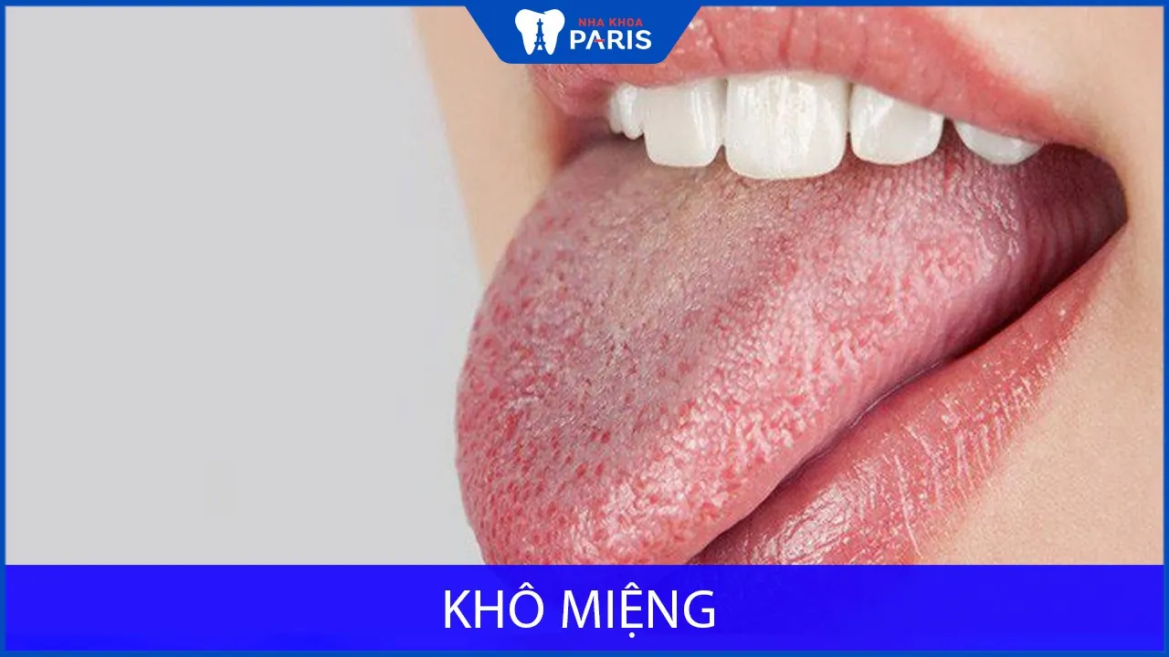 Khô miệng – Nguyên nhân & cách điều trị HIỆU QUẢ