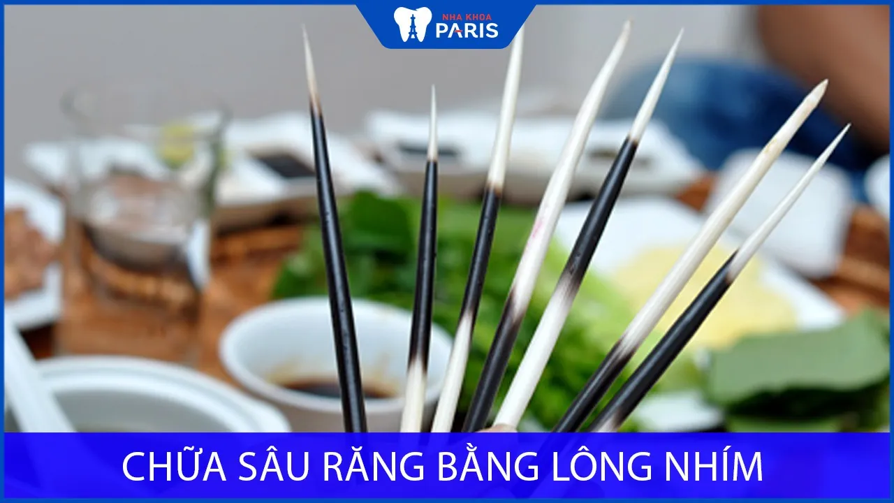 Chữa sâu răng bằng lông nhím liệu có HIỆU QUẢ không?