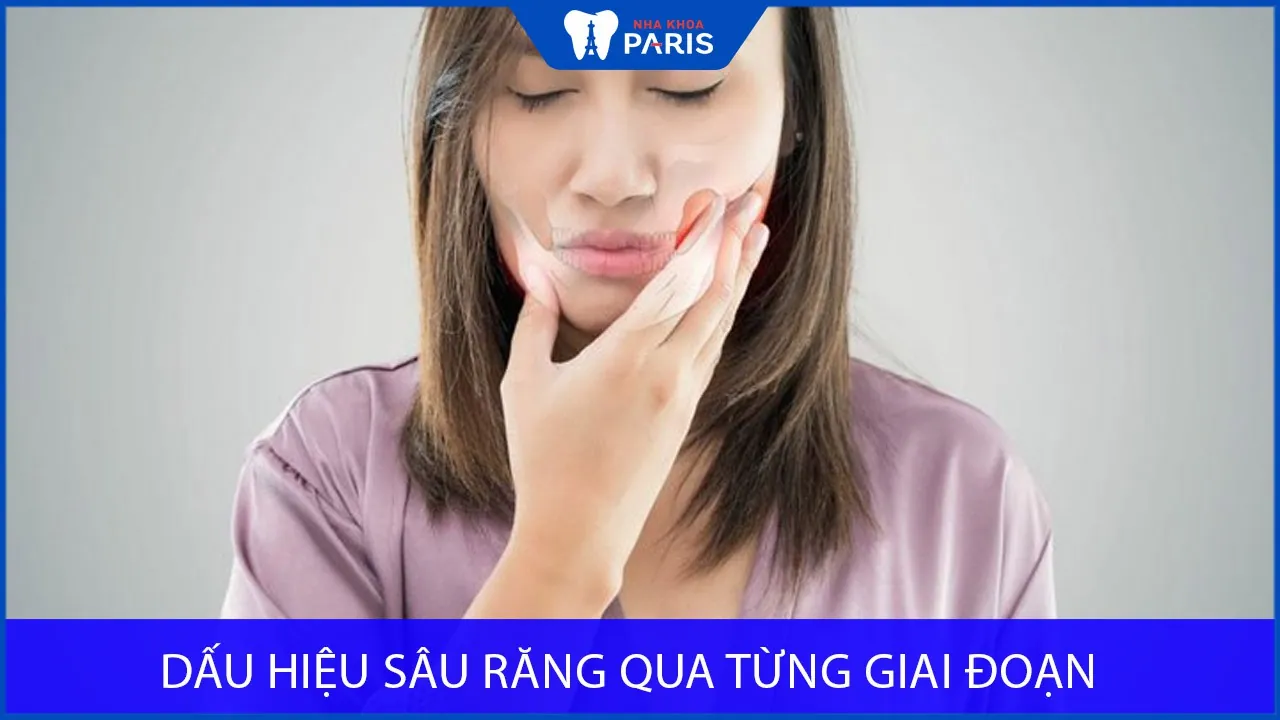 Đau quai hàm là dấu hiệu của bệnh gì? Cách khắc phục HIỆU QUẢ