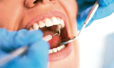 Nhổ răng số 6 bao lâu thì lành, hết chảy máu và ăn uống bình thường?