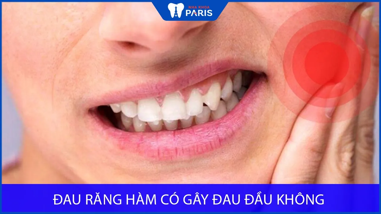 Đau răng hàm có gây đau đầu không? Cách phòng tránh hiệu quả