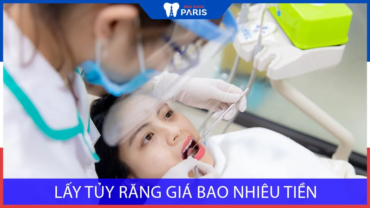 Lấy tủy răng giá bao nhiêu tiền? Giá ưu đãi nhất