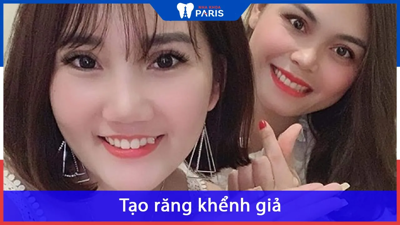 Tạo răng khểnh giả – Xu hướng đang Khuấy Động giới trẻ TKỷ XXI