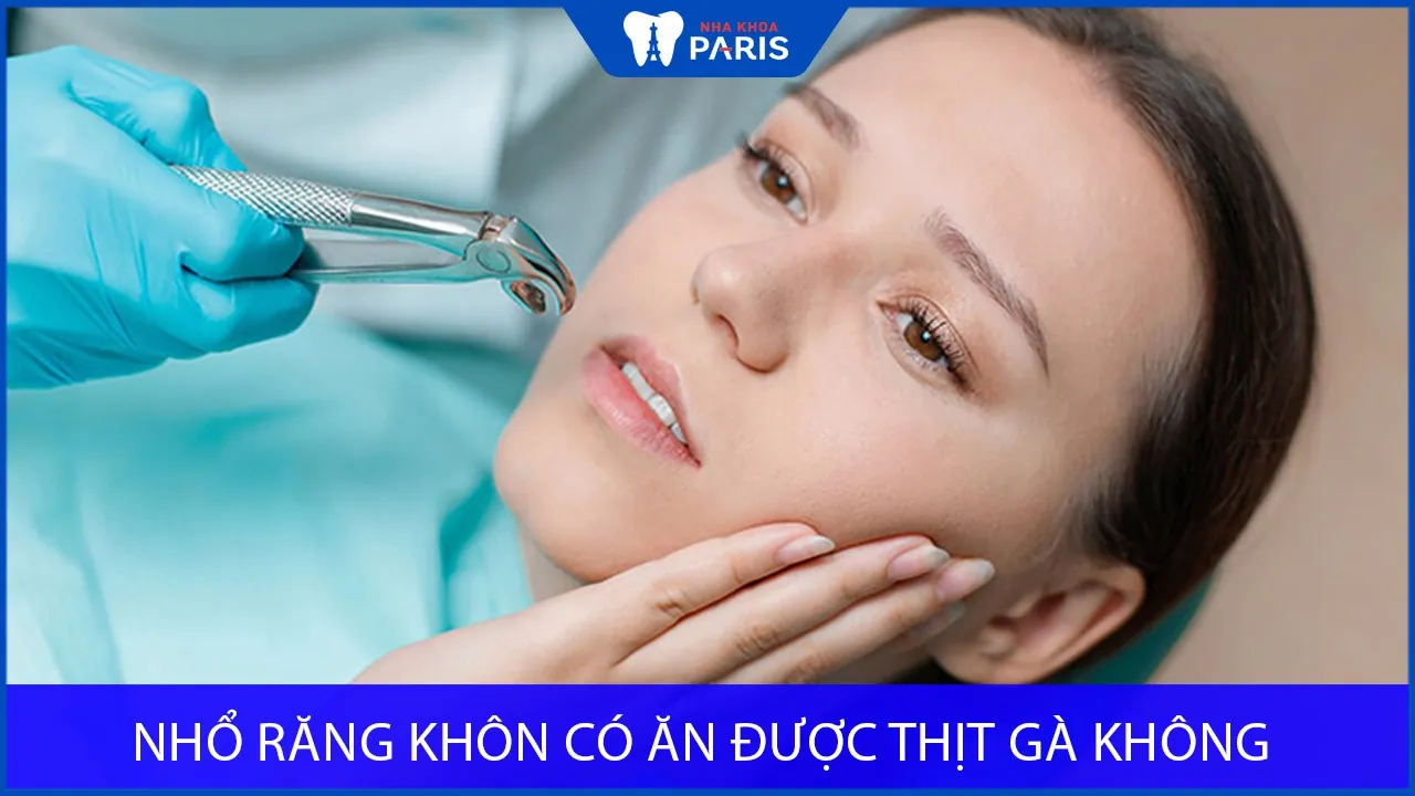 Nhổ răng khôn ở Đà Nẵng làm cách nào tiết kiệm Chi Phí Nhất