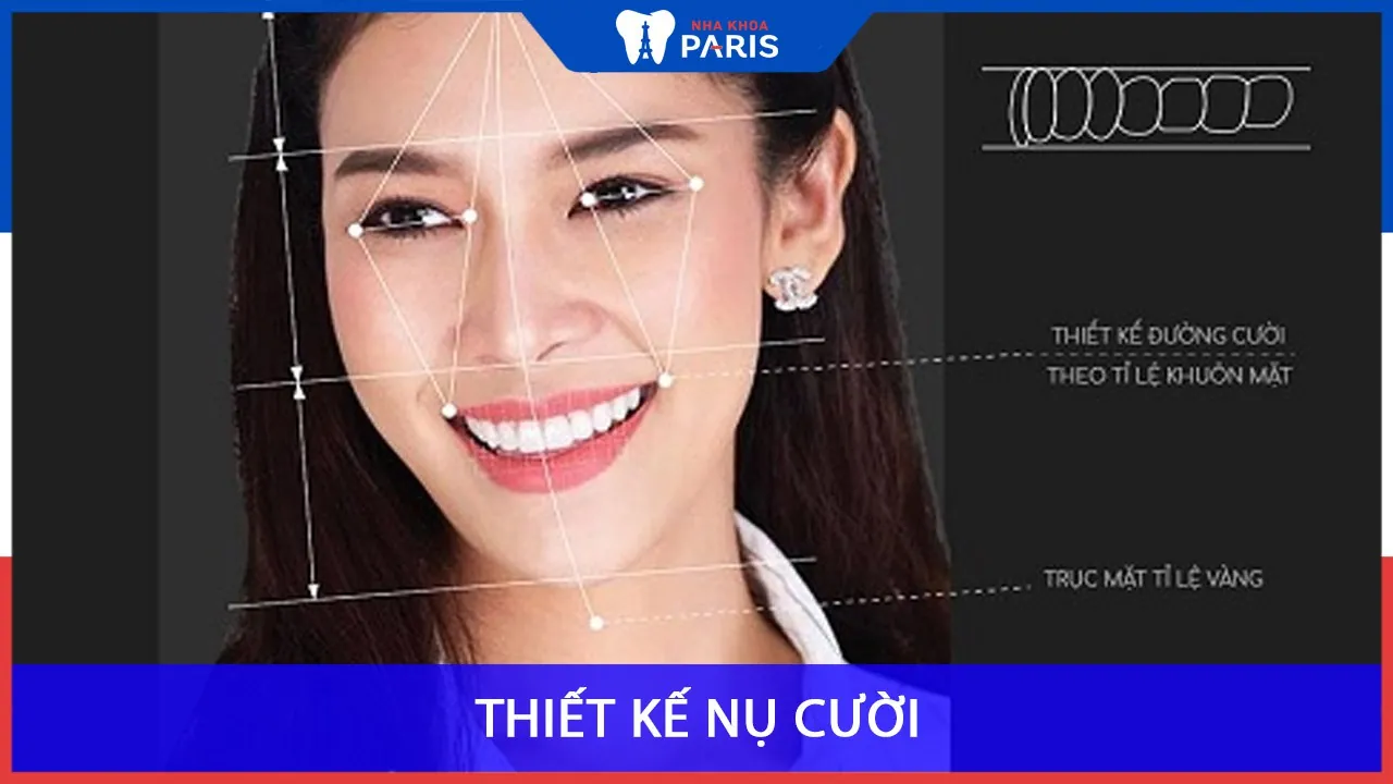 Thiết kế nụ cười là gì? ứng dụng thiết kế nụ cười đẹp