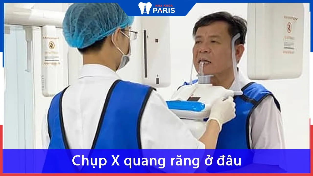 Chụp Xquang răng là gì? Quy trình và lưu ý khi chụp X quang