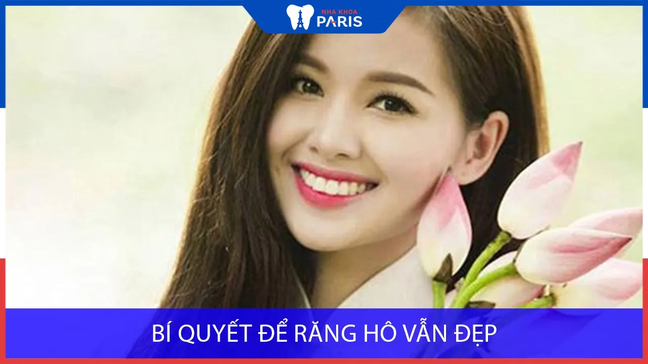 Bí quyết để răng hô vẫn đẹp như các diễn viên