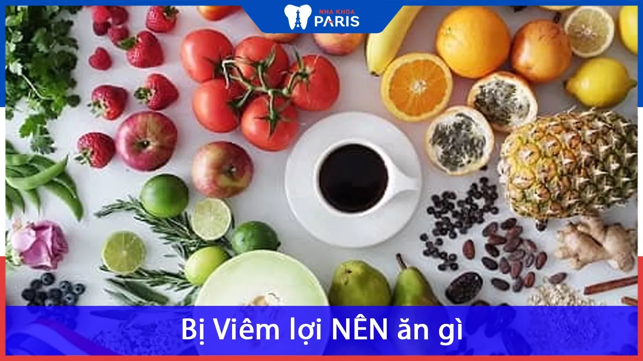 Bị viêm lợi nên ăn gì & kiêng ăn gì để nhanh khỏi