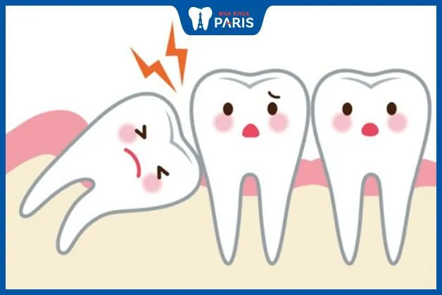 Răng không sâu nhưng đau: Nguyên nhân và Cách điều trị triệt để?