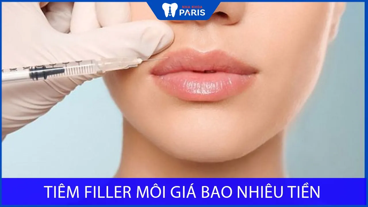 Tiêm filler môi giá bao nhiêu tiền? Có đắt không? [Bảng giá 2025]